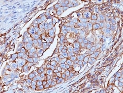 CD44 Antibody (DF1485), Novus Biologicals 0.2mg; Unlabeled:Antibodies,